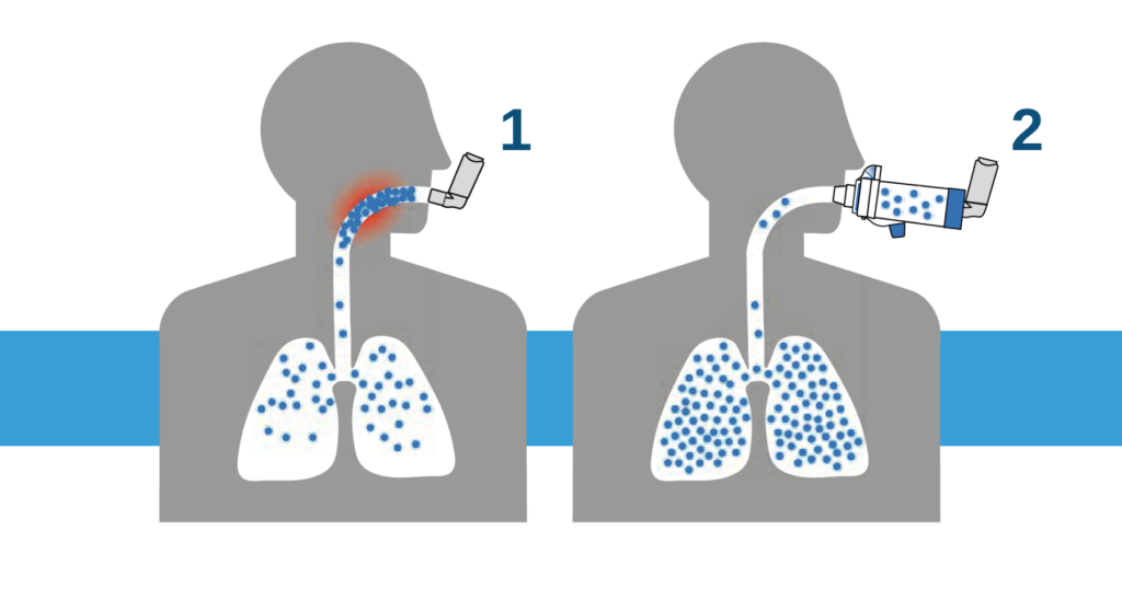 AEROCHAMBER Lungs
