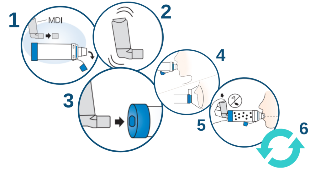 AEROCHAMBER PLUS® Z STAT® AVHC Use