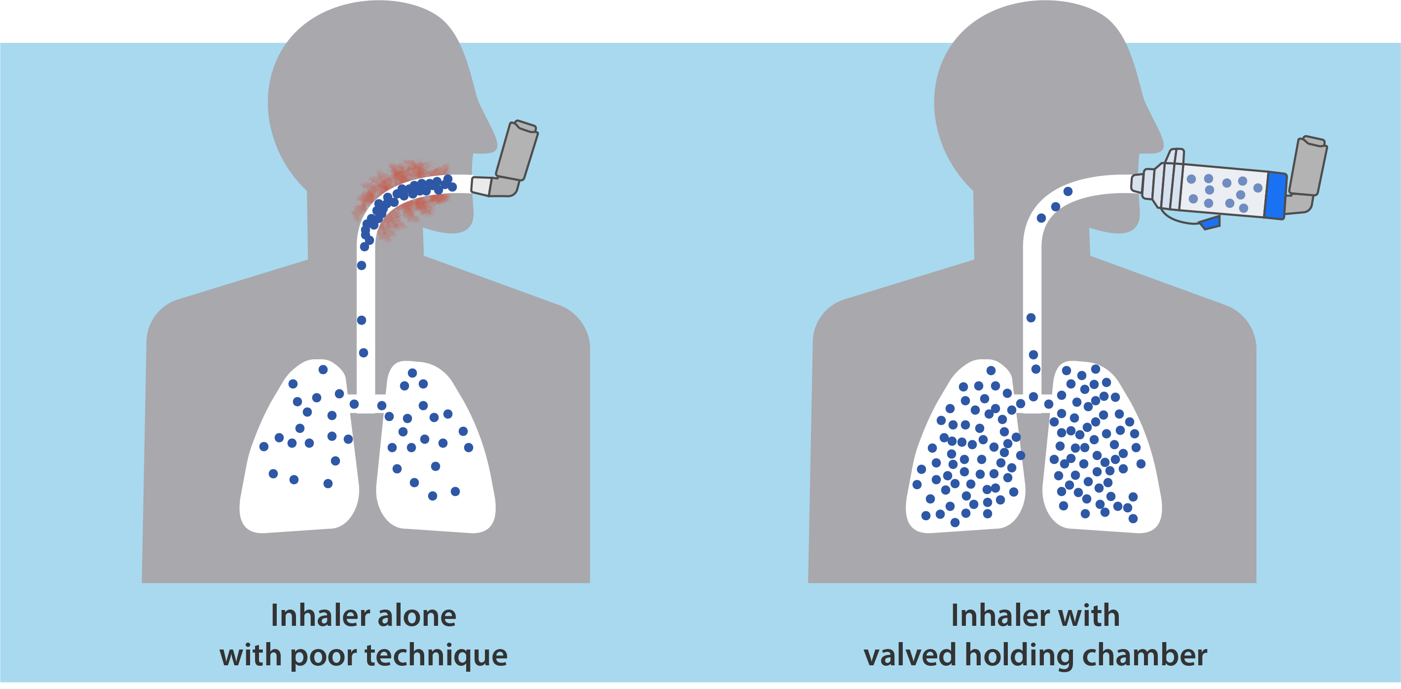 Comparison of inhaler alone vs. MDI with AEROCHAMBER showing increased medication delivery to the lungs.