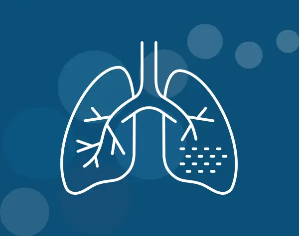 What Is Primary Ciliary Dyskinesia (PCD)?